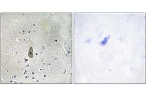Immunohistochemistry analysis of paraffin-embedded human brain, using ROMK/Kir1.
