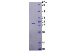 Image no. 1 for Chromosome 6 Open Reading Frame 150 (C6orf150) (AA 225-407) protein (His tag) (ABIN4991123)