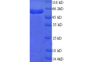 SDS-PAGE (SDS) image for Multiple Inositol-Polyphosphate Phosphatase 1 (MINPP1) (AA 31-487) protein (GST tag) (ABIN5711961) (MINPP1 Protein (AA 31-487) (GST tag))
