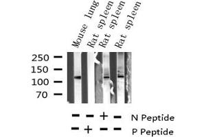 Western blot analysis of Phospho-JAK2 (Tyr221) expression in various lysates
