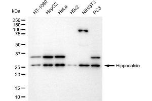 Western blotting analysis using hippocalcin antibody (ABIN7798912). (Recombinant Hippocalcin anticorps)
