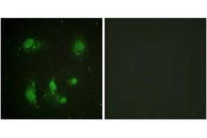 Immunofluorescence analysis of HeLa cells, using Survivin (Ab-117) Antibody.