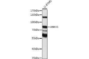Western blot analysis of extracts of U-87MG cells, using  antibody (ABIN7265605) at 1:1000 dilution. (ANKK1 anticorps  (AA 1-300))