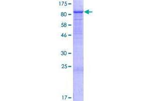 Image no. 1 for GTPase, IMAP Family Member 8 (GIMAP8) (AA 1-665) protein (GST tag) (ABIN1355104)