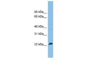 WB Suggested Anti-SPATA24 Antibody Titration: 0. (SPATA24 anticorps  (C-Term))
