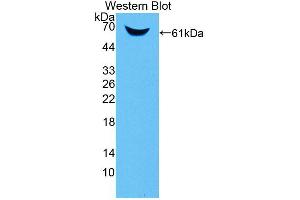 Figure. (ANKRD1 anticorps  (AA 5-279))
