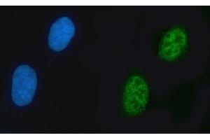 IF analysis of ZNF609 using anti-ZNF609 antibody (ABIN7602578). (ZNF609 anticorps  (AA 865-1283))