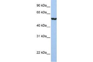 Western Blotting (WB) image for anti-Solute Carrier Family 39 (Metal Ion Transporter), Member 5 (SLC39A5) antibody (ABIN2458817)
