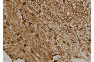 ABIN6273461 at 1/100 staining Mouse brain tissue by IHC-P. (CENPM anticorps  (Internal Region))