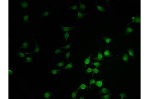 Immunofluorescence staining of A549 cells with ABIN7171058 at 1:100, counter-stained with DAPI. (SMARCC2 anticorps  (AA 300-650))