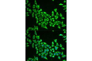 Immunofluorescence analysis of HeLa cell using MRPS30 antibody. (MRPS30 anticorps)