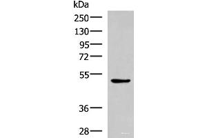 Western blot analysis of LOVO cell lysate using BLNK Polyclonal Antibody at dilution of 1:600