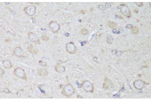 Immunohistochemistry of paraffin-embedded Rat brain using GANAB Polyclonal Antibody at dilution of 1:150 (40x lens). (GANAB anticorps)