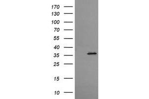 Western Blotting (WB) image for anti-T-cell surface glycoprotein CD1c (CD1C) antibody (ABIN2670671) (CD1c anticorps)