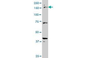 CUTL1 monoclonal antibody (M02), clone 2D10 Western Blot analysis of CUTL1 expression in Hela S3 NE . (CUX1 anticorps  (AA 521-620))