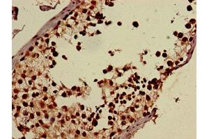 Immunohistochemistry of paraffin-embedded human testis tissue using ABIN7170614 at dilution of 1:100