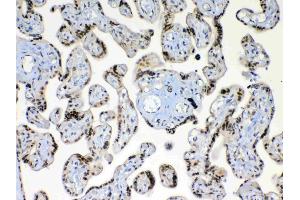 IHC analysis of XRCC1 using anti-XRCC1 antibody .