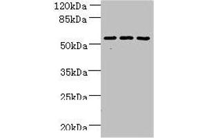 Western blot All lanes: ZNF19 antibody at 4 μg/mL Lane 1: Mouse liver tissue Lane 2: MDA-MB-231 whole cell lysate Lane 3: HepG2 whole cell lysate Secondary Goat polyclonal to rabbit IgG at 1/10000 dilution Predicted band size: 53, 52 kDa Observed band size: 53 kDa (ZNF19 anticorps  (AA 1-200))