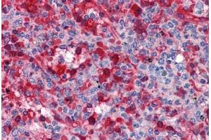 Human Spleen: Formalin-Fixed, Paraffin-Embedded (FFPE) (WDR20 anticorps  (AA 1-570))