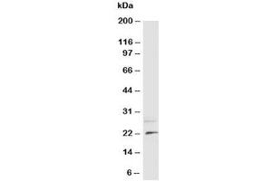 Western blot testing of NGF antibody and rat brain tissue lysate (Nerve Growth Factor anticorps  (N-Term))