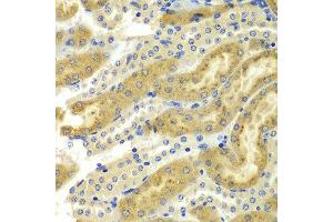 Immunohistochemistry of paraffin-embedded mouse kidney using PAK2 antibody at dilution of 1:100 (x400 lens). (PAK2 anticorps)