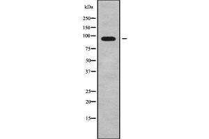 Western blot analysis of ADAM29 using COLO205 whole cell lysates (ADAM29 anticorps  (C-Term))