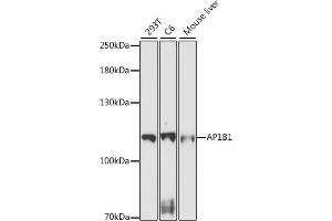 Western blot analysis of extracts of various cell lines, using B1 antibody (ABIN7265445) at 1:1000 dilution. (AP1B1 anticorps  (AA 700-800))