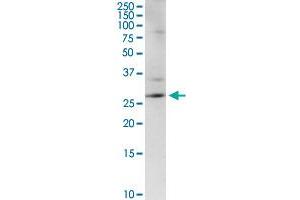 CENPH MaxPab rabbit polyclonal antibody. (CENPH anticorps  (AA 1-247))