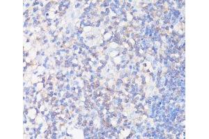 Immunohistochemistry of paraffin-embedded Human appendix using CFL1 Polyclonal Antibody at dilution of 1:100 (40x lens). (Cofilin anticorps)