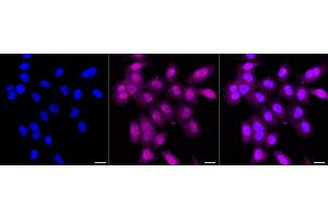 Immunocytochemical staining of HepG2 cells with PPP1CA + 1CB antibody (ABIN7799892), 1:1,000). (Recombinant PPP1CA + 1CB anticorps)