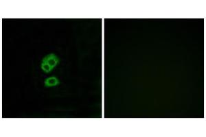 Immunofluorescence analysis of MCF-7 cells, using OR2T10 antibody. (OR2T10 anticorps  (Internal Region))
