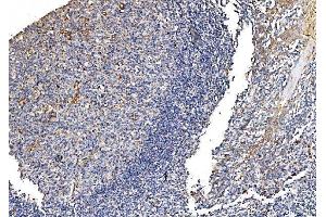 IHC analysis of GFPT1 using anti-GFPT1 antibody (ABIN7602887). (GFPT1 anticorps  (C-Term))