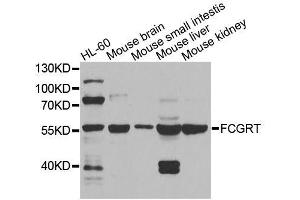 Western blot analysis of extracts of various cell lines, using FCGRT antibody (ABIN5995932) at 1/1000 dilution. (FcRn anticorps)