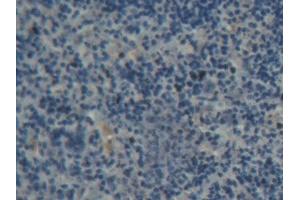 DAB staining on IHC-P; Samples: Rat Spleen Tissue