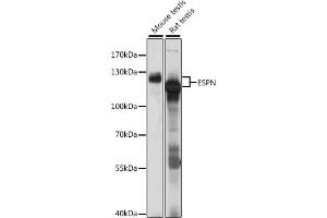 Western blot analysis of extracts of various cell lines, using ESPN antibody (ABIN7267008) at 1:1000 dilution.