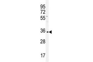 Western blot analysis of IGHA1 antibody and CEM lysate. (IGHA1 anticorps  (AA 257-286))