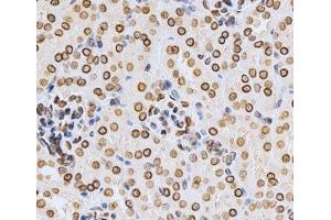 Immunohistochemistry of paraffin-embedded Mouse kidney using Lamin A/C Polyclonal Antibody at dilution of 1:200 (40x lens). (Lamin A/C anticorps)