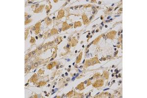 Immunohistochemistry of paraffin-embedded human stomach using PRKAA1 antibody at dilution of 1:200 (x400 lens).