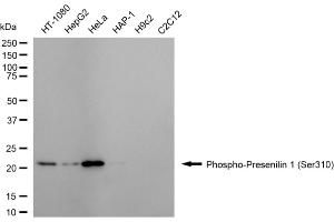 Western blotting analysis using phospho-presenilin 1 (Ser310) antibody (ABIN7799896). (Recombinant Presenilin 1 anticorps  (pSer310))