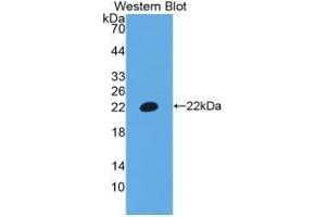 Detection of Recombinant CD3e, Human using Polyclonal Antibody to T-Cell Surface Glycoprotein CD3 Epsilon (CD3e) (CD3 epsilon anticorps  (AA 28-185))
