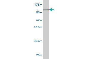 Western Blot detection against Immunogen (91. (GAD anticorps  (AA 1-594))