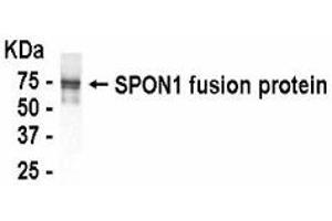 Western Blotting (WB) image for anti-Spondin 1 (SPON1) (AA 549-807) antibody (ABIN2467891)
