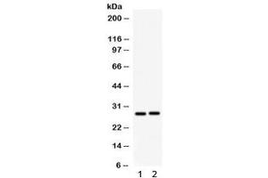Western blot testing of 1) rat kidney and 2) mouse kidney lysate with IGFBP1 antibody.