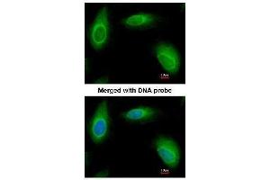 AP19035PU-N Ran BP1 antibody staining of Paraformaldehyde-fixed HeLa by Immunofluorescence at 1/200 dilution.