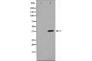 Western blot analysis on HepG2 cell lysate using XRCC3 Antibody.