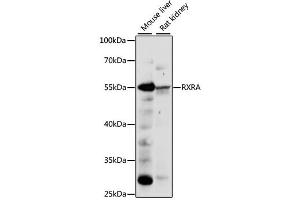 Western blot analysis of extracts of various cell lines, using RXRA antibody (ABIN6290900) at 1:1000 dilution. (Retinoid X Receptor alpha anticorps)