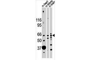Western blot analysis of ACVR2B polyclonal antibody  in mouse heart, kidney and brain lysates (35 ug/lane). (ACVR2B anticorps  (N-Term))