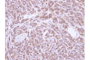 IHC-P Image Immunohistochemical analysis of paraffin-embedded U87 xenograft, using PCMT1, antibody at 1:500 dilution.