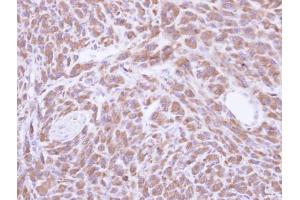 IHC-P Image Immunohistochemical analysis of paraffin-embedded U87 xenograft, using PCMT1, antibody at 1:500 dilution. (PCMT1 anticorps)