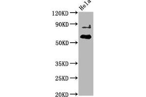Western Blot Positive WB detected in Hela whole cell lysate All lanes Phospho-AKT1 antibody at 2. (Recombinant AKT1 anticorps  (pThr450))